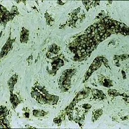 Anti-MVP/LRP antibody [1032] used in IHC (Paraffin sections) (IHC-P). GTX22376